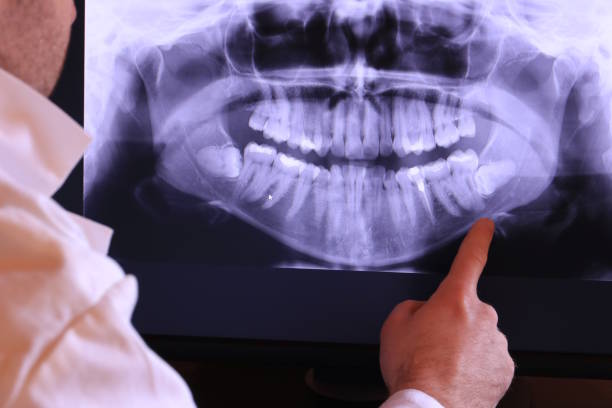Best Knocked-Out Tooth Emergency  in Broomall, PA